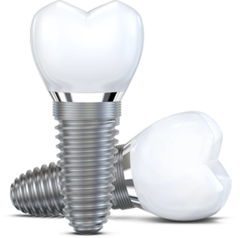 Dental implants