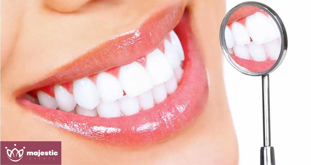İstanbul Diş Beyazlatma, Türkiye | İstanbul Diş Beyazlatma Kliniği - Majestic Clinic Smile